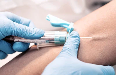 Blodprov för cancermarkörer